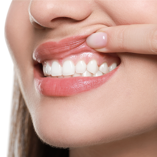 Gum disease and gum infection symptoms